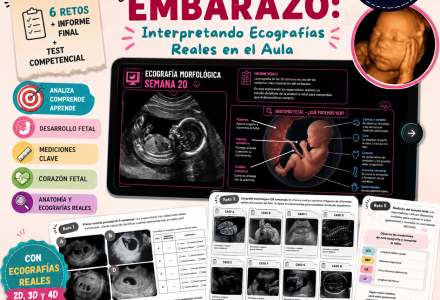 Expedición al Interior del Embarazo: Interpretando Ecografías Reales en el Aula