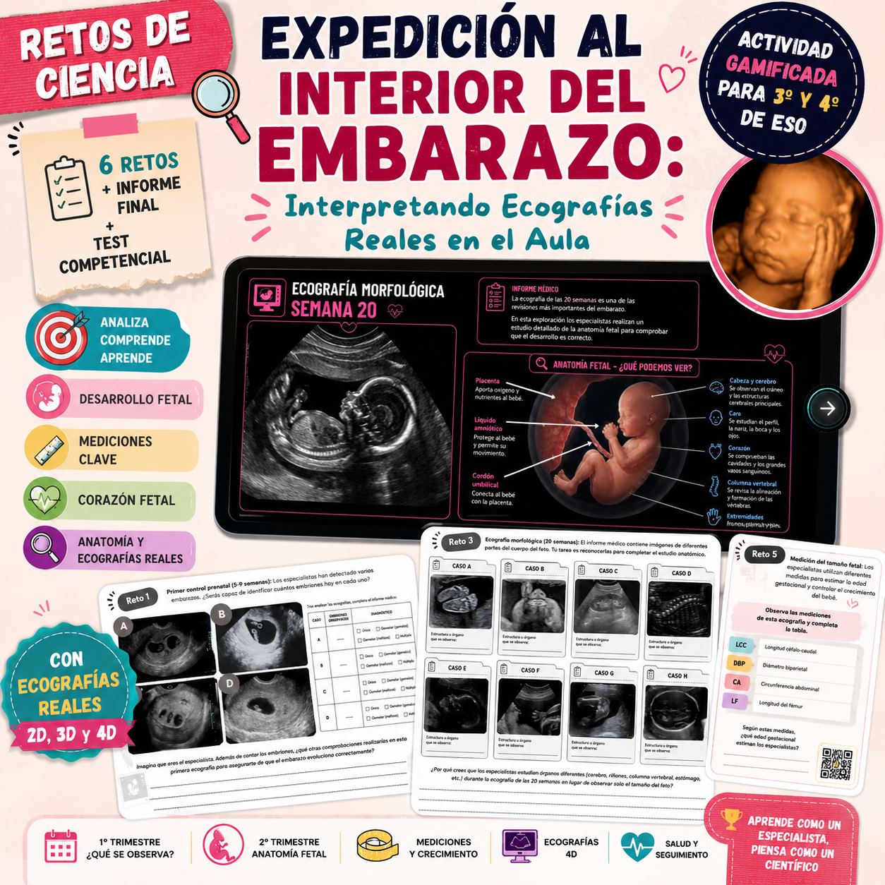 Expedición al Interior del Embarazo: Interpretando Ecografías Reales en el Aula